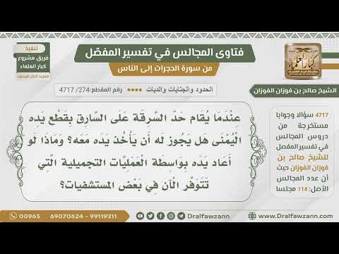 [274- 4717] حكم تمكين السارق من إعادة يده بواسطة العمليات التجميلية