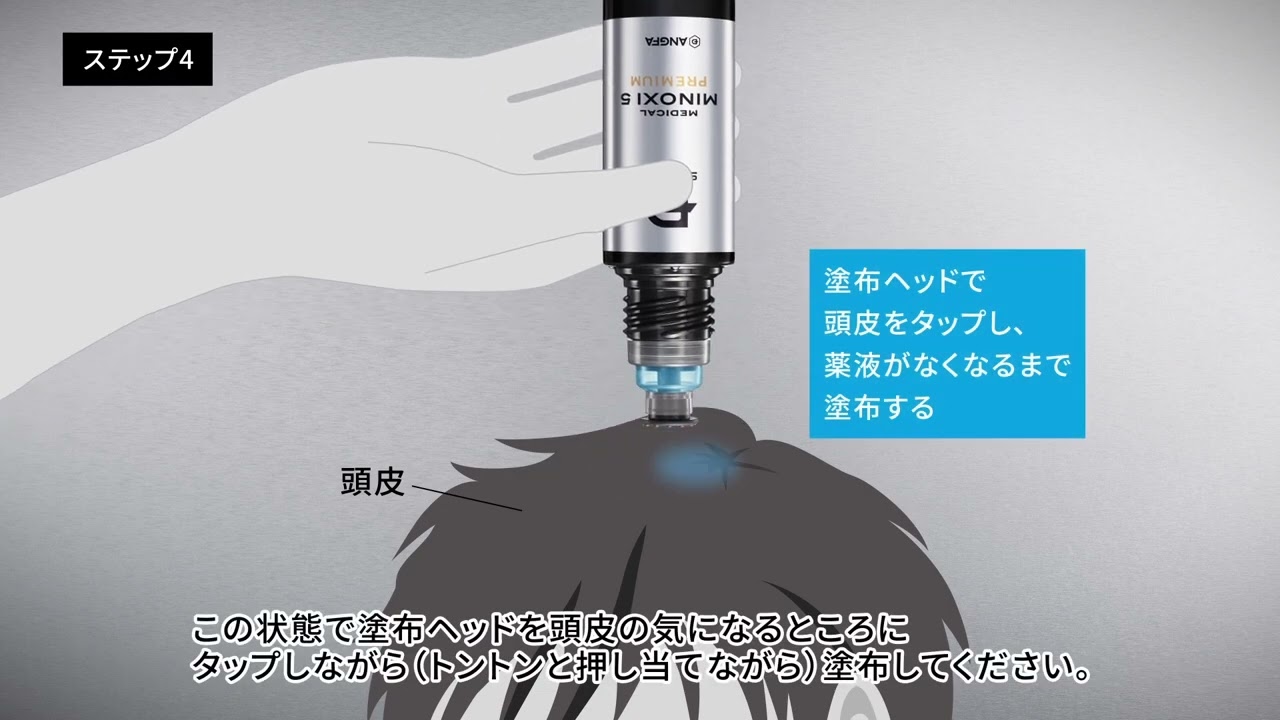 スカルプＤ　メディカルミノキ５　プレミアム　4本セット（ミノキ補償制度付帯セット）​の使い方