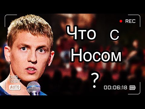 Что с носом? Алексей Щербаков. Ответы на вопросы!