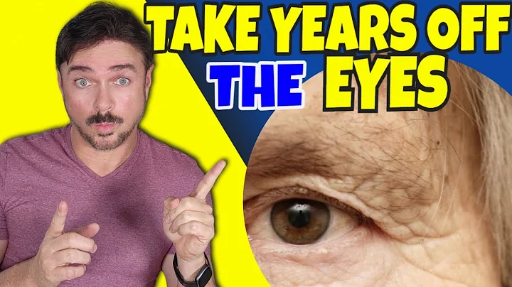 Take 20 Years Off Your Eye Area | Chris Gibson