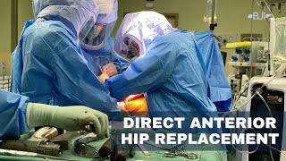 Anterior Approach Hip Replacement Surgery