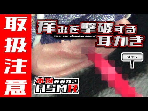 痒みを撃破する耳かきとは⁉本物の耳かき音  Real Ear Cleaning Sound ASMR إذن