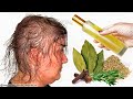 150 times stronger than onion and garlic!!! Hair grows extremely fast!! rosemary oil for hair growth