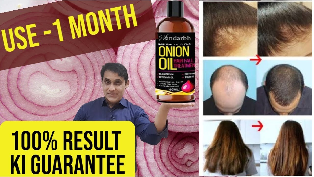KURAIY Hair Fast Growth And Hair Care Essential Oil Natural Onion Hair  Regrowth Products Serum Hair Care Hair Loss 50 ML  JioMart