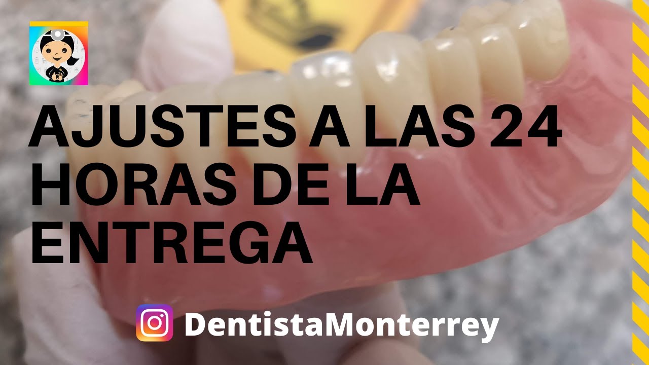 AJUSTES Y Pulido a las 24 Horas 👅PRÓTESIS DENTAL Inferior Parte4 