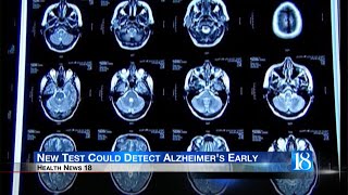 Health News 18: A new study suggests a simple blood test that screens for Alzheimer's disease may be
