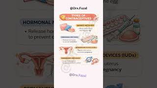 Contraceptive Types | Birth Control Methods | Family Planning Methods | Pills, Copper T, Condoms 😱