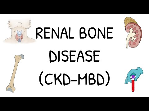 Renal Bone Disease (CKD-MBD) - Explained simply and clearly