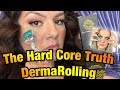 HONEST DERMA ROLLING 30 DAY REVIEW PICTURES & EVIDENCE DOES IT WORK?!! Gin Amber Beauty Roller