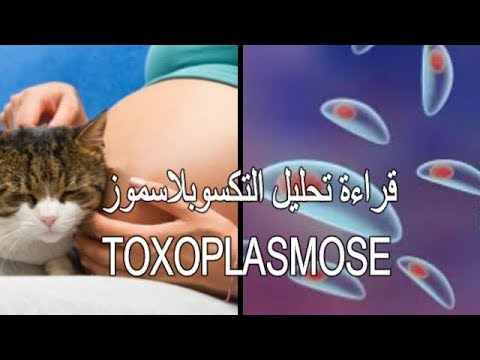 داء القطط وخطورته على المراة الحامل Toxoplasmose Youtube