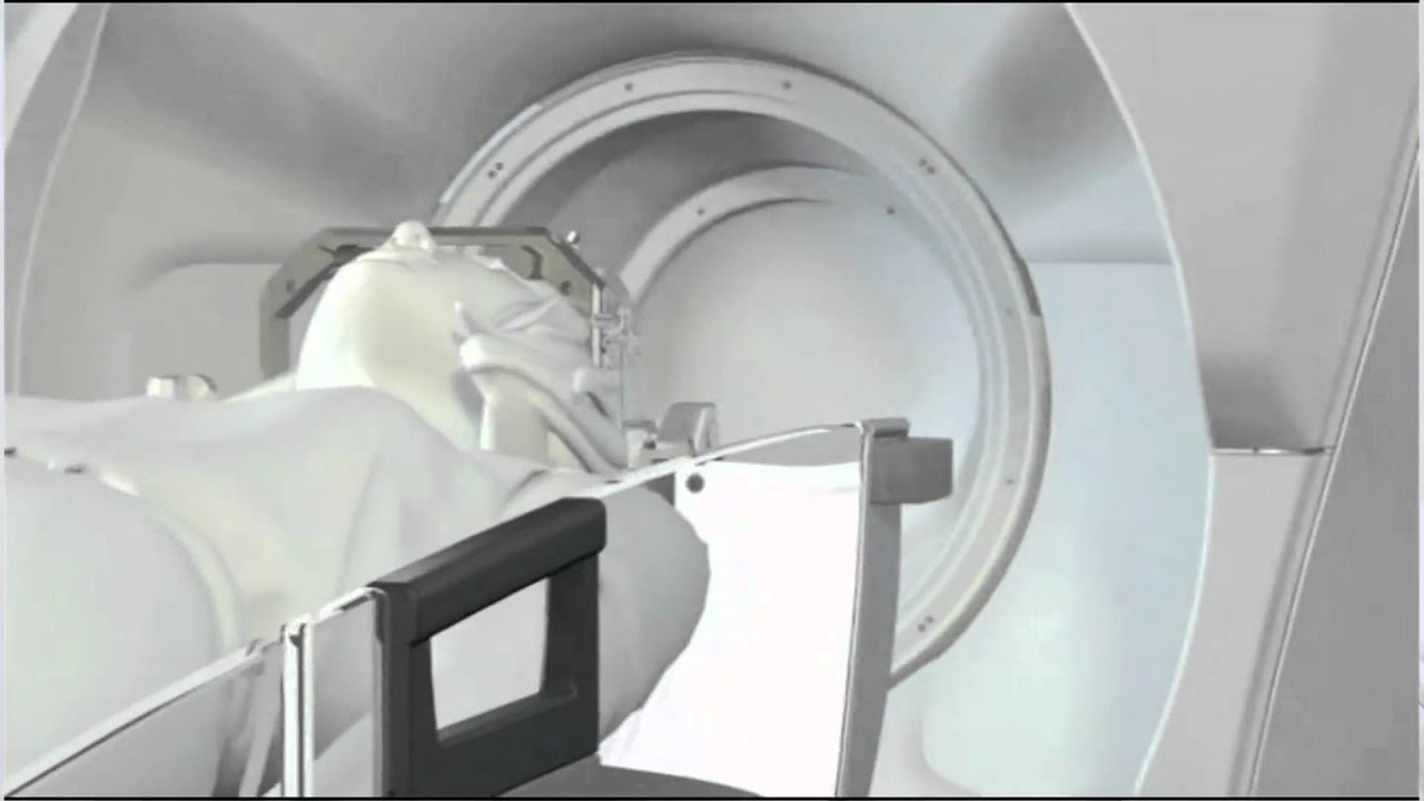 Gamma Knife Perfexion How It Works YouTube Gamma Knife Perfexion How It Works YouTube
