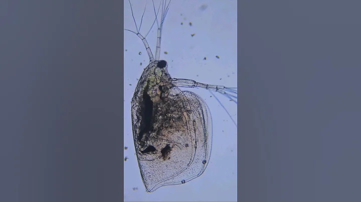 Testing the effects of water purification tablets on murky pond water under a microscope🔬