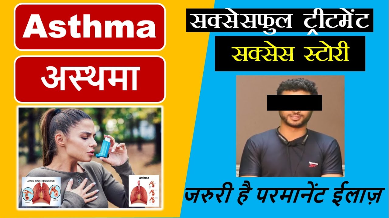 Bronchial Allergic Asthma treatment Treatment Detail Dr. Arpit