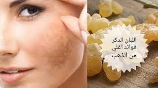 علاج الكلف | كلف الوجه وكيفية التخلص منه | علاج بقع الوجه | كلف الوجه بعد الولادة والتخلص منه