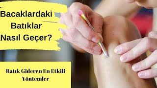 Bacaklardaki Batıklar Nasıl Geçer? En Etkili Yöntemler