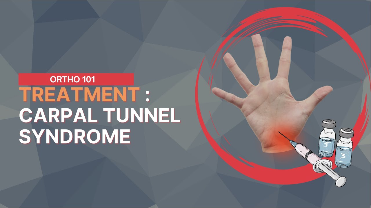 Stages To Treat Carpal Tunnel Syndrome Painful Numb Hands Ortho 101 