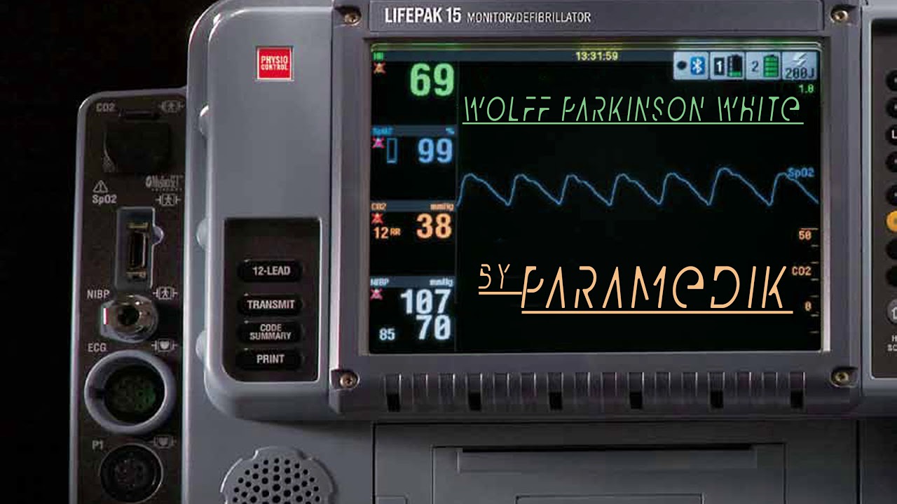 Guarda Paramedik - WPW su YouTube Guarda Paramedik - WPW su YouTube