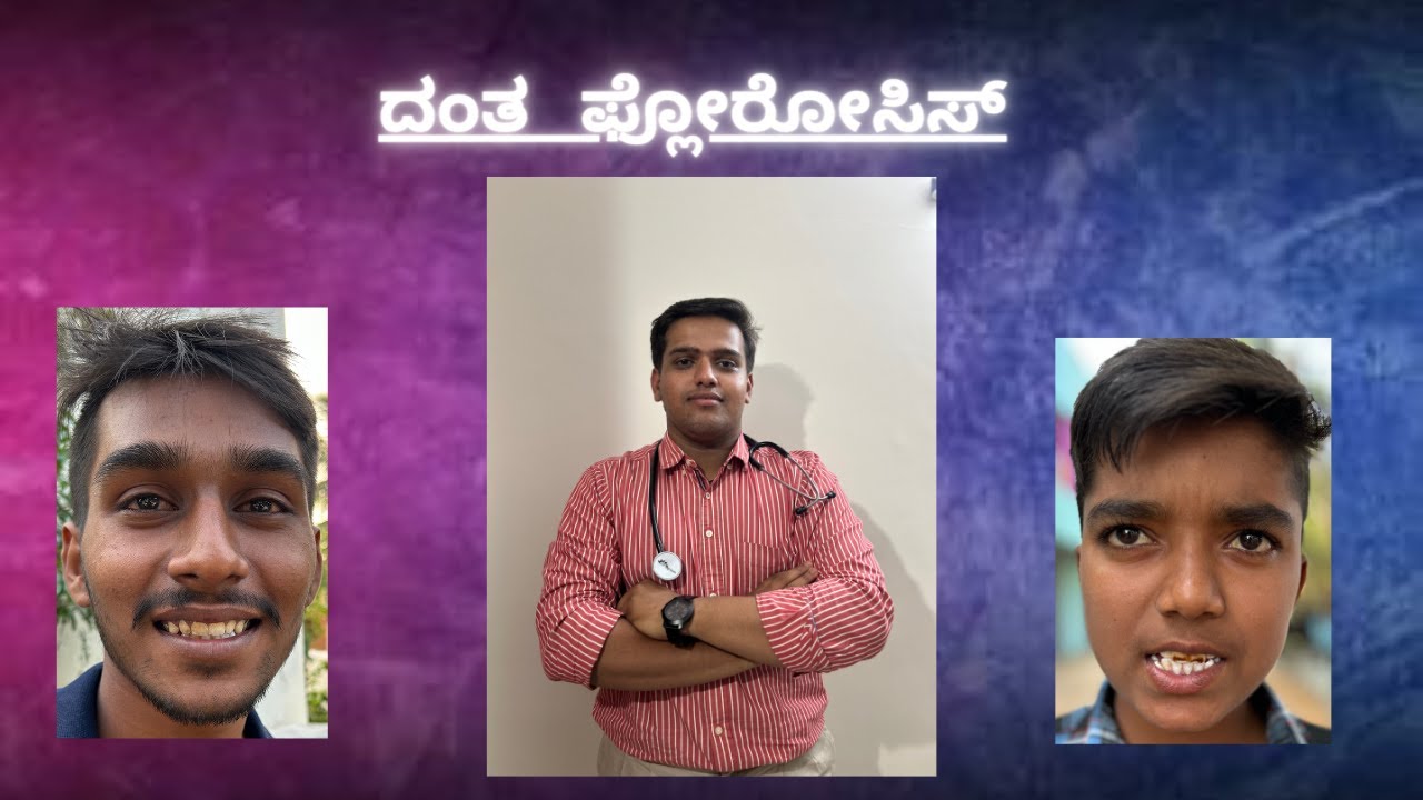 ORAL HEALTH TALK ON DENTAL FLUOROSIS IN KANNADA YouTube