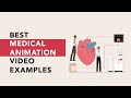 8 best examples of medical animations to watch in 2024