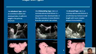 WATCHMAN LAA Closure Technology Implant Procedure