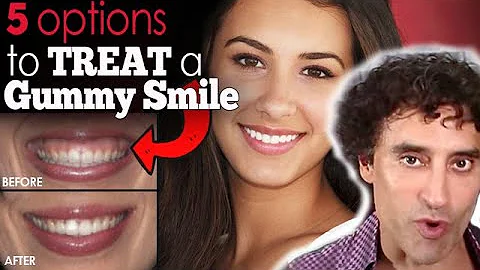 5 OPTIONS TO TREAT A GUMMY SMILE - Doctor's Advice