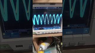 NON LDmos RF amplifier Input stage January 11, 2023