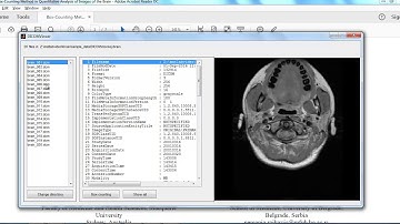 matlab based mini projects | matlab based mini thesis | matlab based mini projects code