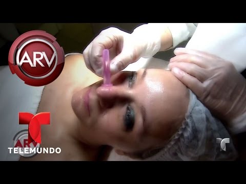 Vídeo: Ventosas Faciales: Cómo Funciona, Beneficios, Efectos Secundarios Y Más