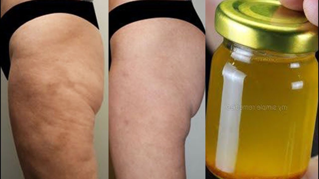 videos de belleza para el cabello 👉Aplica Después de Ducharte y Elimina la Celulitis EN SEMANAS! Elimina celulitis y Estrías