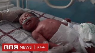 アフガニスタンで流産や新生児の死亡が倍増　産院をBBCが取材