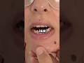 Unlocking the Power of Your TMJ What You Need to Know
