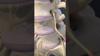 Think You Have Sciatica? Here's What It Really Means