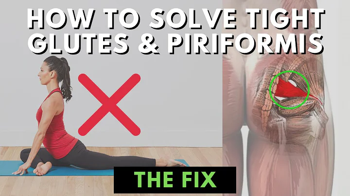 The Root Cause of Tight Glutes & Piriformis - DayDayNews