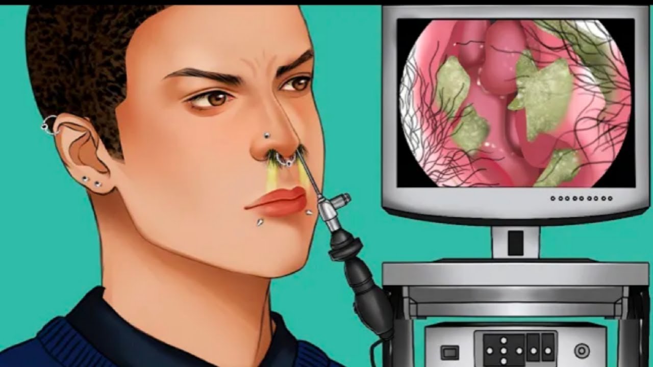 Endoscope Animation ASMR Endoscope Cleaning waste in the nostril animation 콧구멍의 노폐물 청소 ...