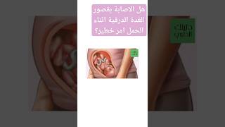 #قصور_الغدة_الدرقية_و_الحمل#دليلك_الطبي_الماحي   #افهم_مرضك_اعتني_بصحتك