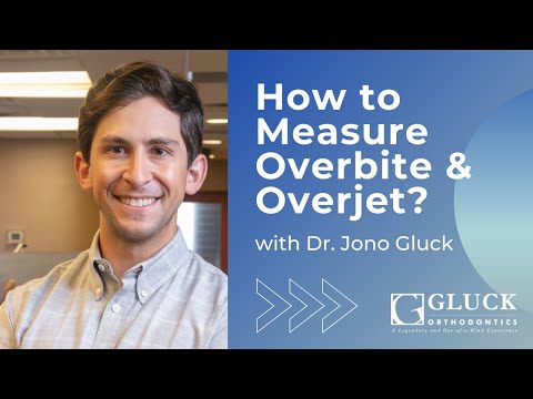 How to Measure