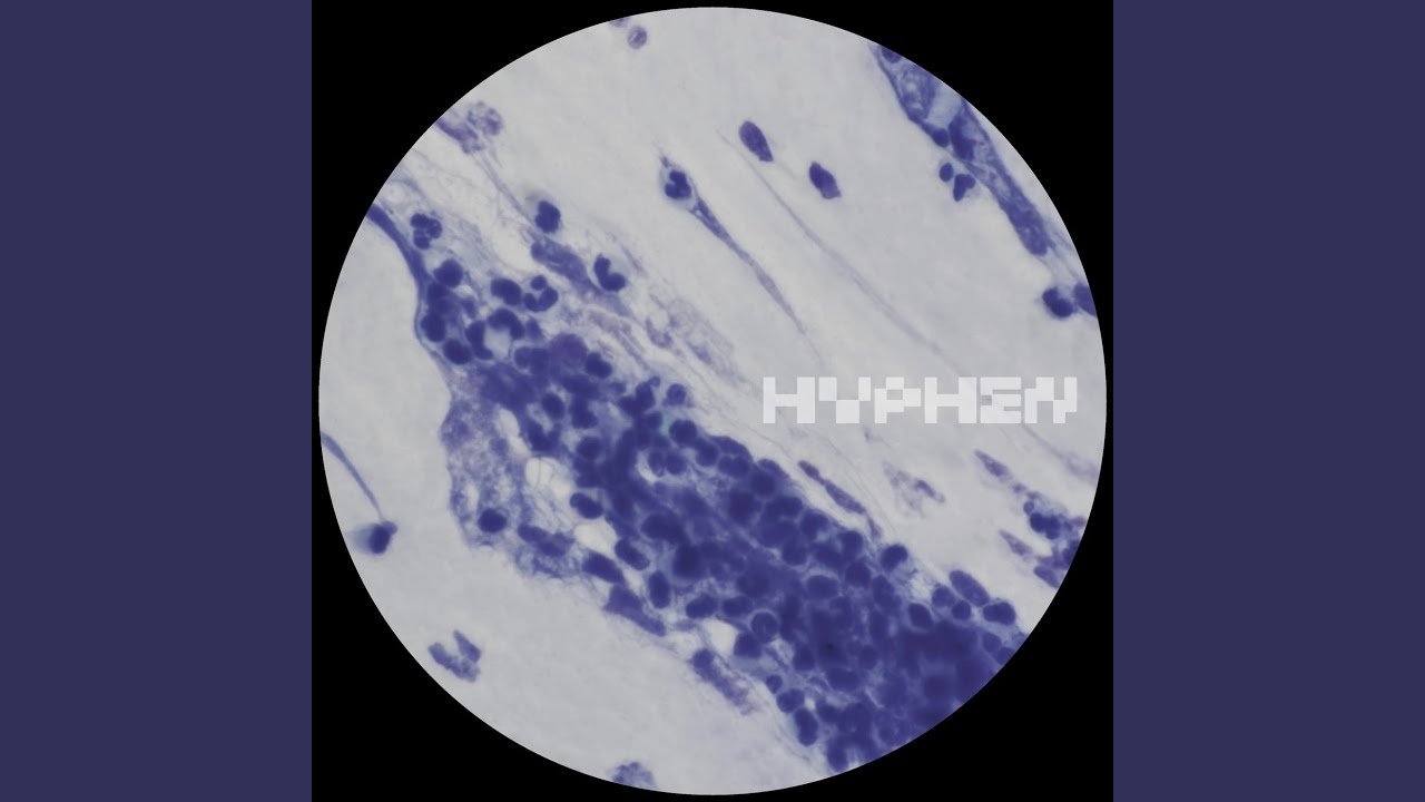 Watch Hydrate (Rorschack Remix) on YouTube Watch Hydrate (Rorschack Remix) on YouTube