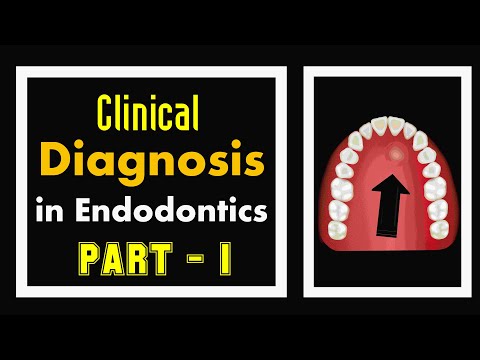 The Biggest Mistake In SDN Endodontics 2025 (And How To Avoid It)
