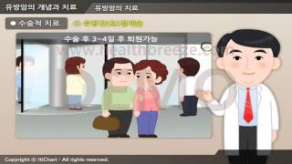 [시연용] a0050aako 유방암의 개념과 치료
