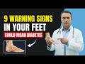 9 Warning Signs in Your Feet That Could Mean Diabetes — A Surgeon Explains