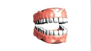 Dentures
