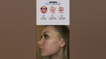 Get Sharper Jawline with this Exercise 🔥😳#glowup #jawline #mewing #exercise #viral #shorts