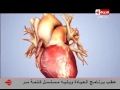 العيادة د جمال شعبان أستاذ أمراض القلب فيديو يوضح تأثير التدخين على القلب  