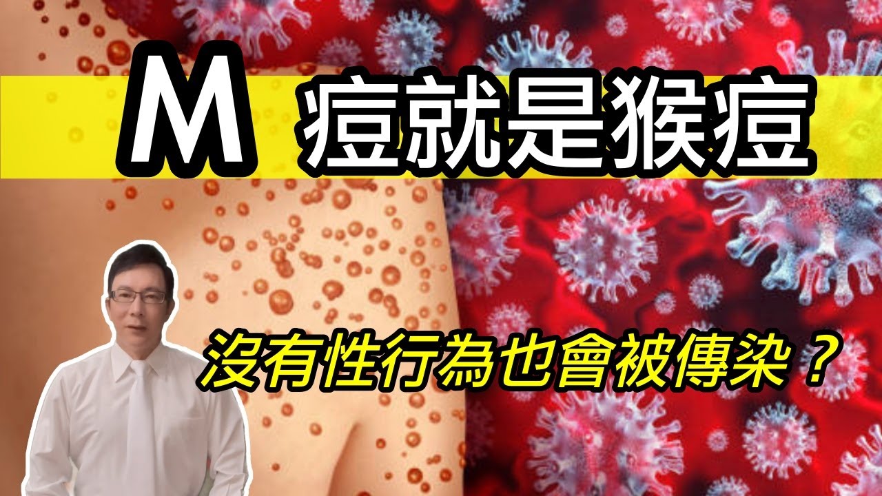 M痘疫情升溫！M痘就是猴痘｜沒有性行為也會被傳染？ - YouTube