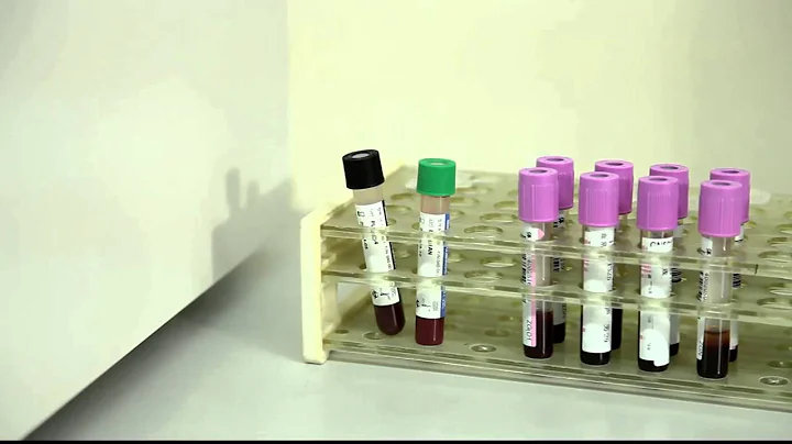 MINDRAY BC 5000-5300