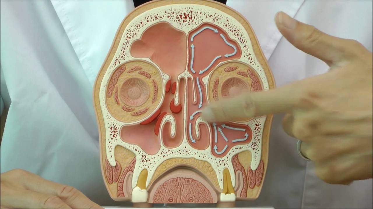 副鼻腔炎の説明に，副鼻腔炎と正常な副鼻腔の状態を再現した模型│C13