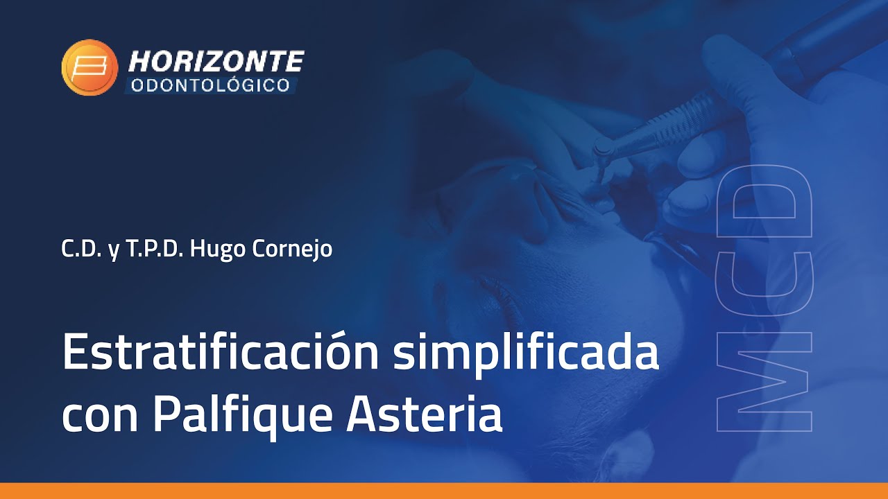 Mesa Clínica Dental - Estratificación simplificada con Palfique Asteria