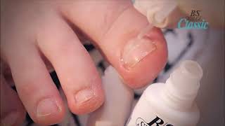 BS Brace Application screenshot 3