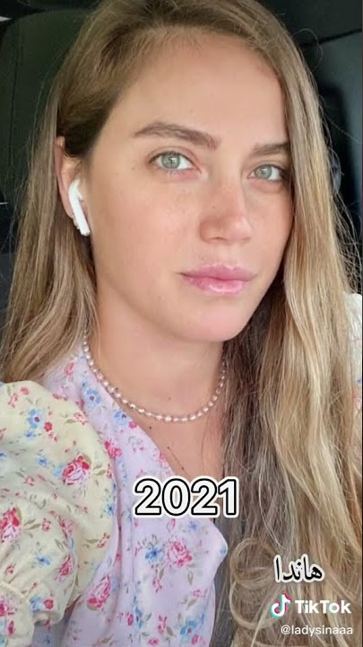 أبطال مسلسل أسميتها فريحة قبل و بعد 😳💕