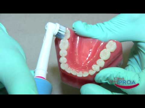 Vídeo: Cómo Cepillarse Los Dientes Con Un Cepillo De Dientes Eléctrico O Estándar